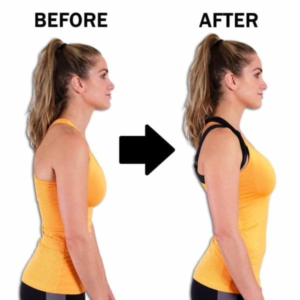 AlignPro™ Posture Corrector